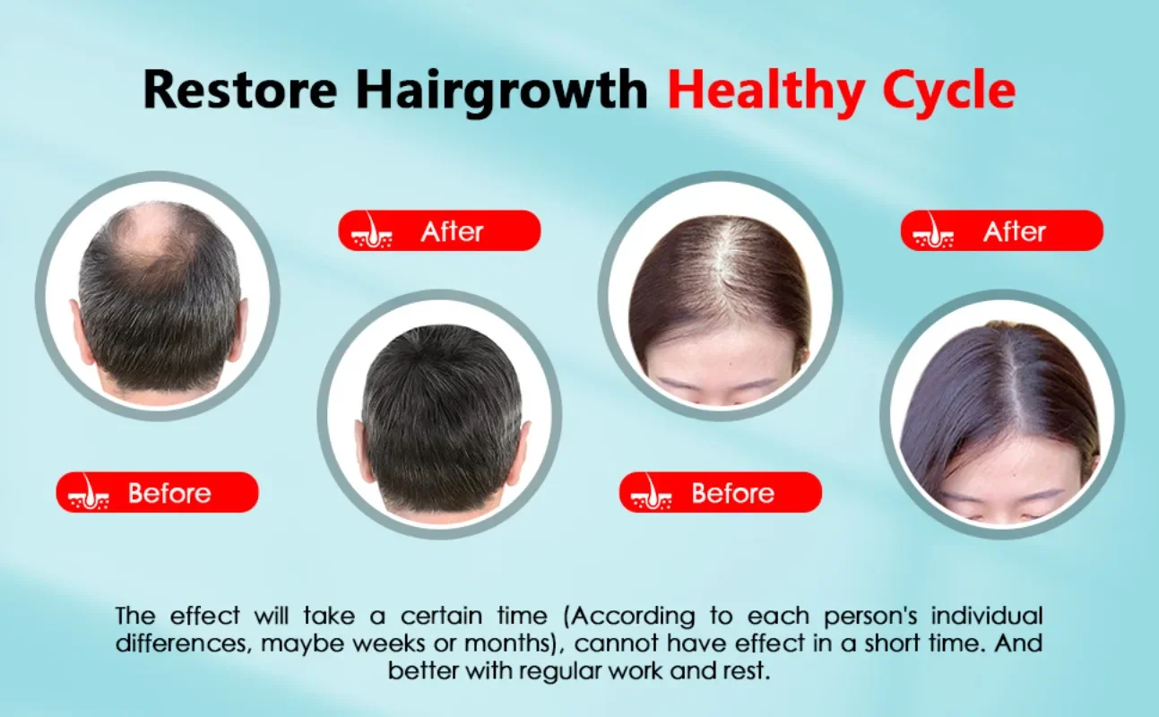 Haarwachstumskappe, wiederaufl – Hair Care With Protein Bewertung und Preis
