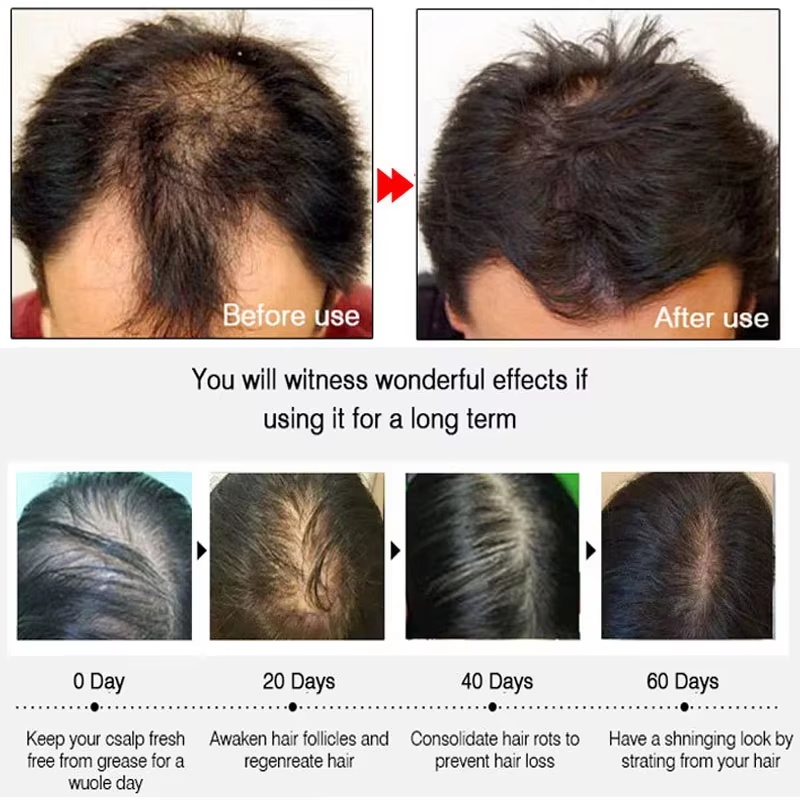 Schnelles Ingwer-Haarwuchsspra – Hair Care With Protein Bewertung und Preis